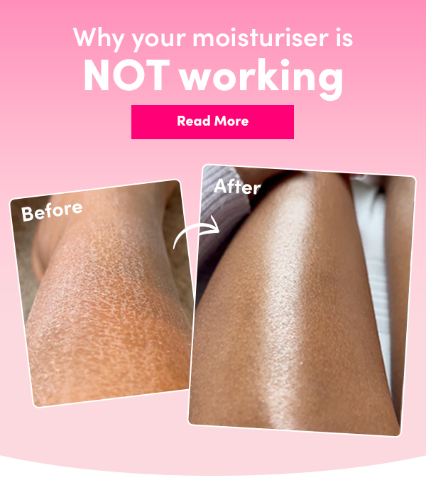 Expert tips How to care for dry skin 💦 Coco And Eve